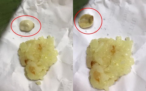Cô nàng khóc ròng vì gặp "vật thể lạ" trong gói xôi xéo, dân mạng không an ủi mà chỉ khuyên 1 điều