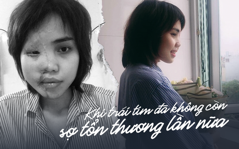 Cô gái bị chồng sắp cưới tạt axit trong ngày kẻ ác đền tội: "Từ lâu tôi đã không còn quan tâm đến người đàn ông ấy"