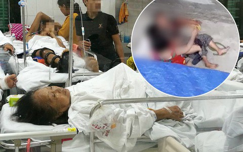 Cụ bà bị chó dữ tấn công ở Hà Nội phải khâu 30 mũi, kể lại giây phút ám ảnh khi đối mặt với tử thần