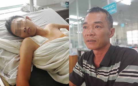 Cha mẹ bật khóc khi bác sĩ gạt mọi thủ tục để cứu con trai bị tràn máu màng phổi, hôn mê sâu nguy kịch