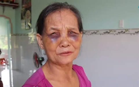 Vụ con dâu đánh mẹ chồng sưng tím mặt: Con dâu ân hận xin lỗi nhưng mẹ chồng chưa chấp nhận cho về nhà