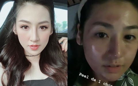 Phải chăng nhờ phương pháp nghe tên đã thấy hơi “rén” này, Á hậu Tú Anh mới sở hữu làn da mộc đẹp căng đến vậy? 