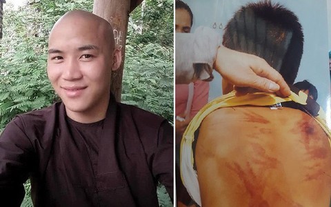 Sau vụ "thầy tu" bị tố dâm ô, đánh dã man bé trai 11 tuổi, phụ huynh nói gì về các khóa học mùa hè?