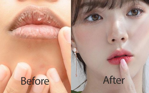 Đánh son đắt tiền đến đâu mà bỏ qua bước này thì môi cũng khó đẹp được như người ta