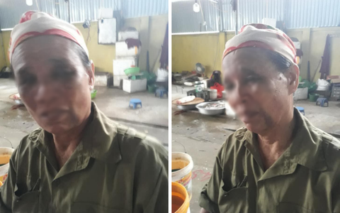 Nghi án con trai làm ngơ để vợ ngược đãi mẹ ruột, đánh mẹ bầm tím mặt rồi không cho ăn cơm