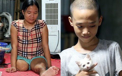 Chuyện rớt nước mắt sau túp lều dựng tạm ven đường của người mẹ cụt chân, một mình nuôi con trai khờ ở Hà Nội