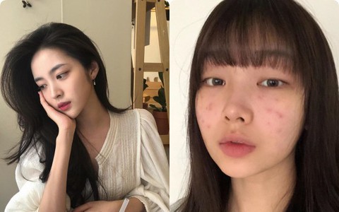 Lại thêm một thói quen hủy hoại làn da, dù bác sĩ da liễu có cảnh báo thế nào thì các chị em vẫn cứ làm như thường
