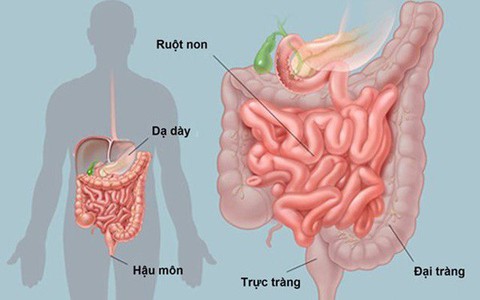 Người mệt mỏi, gầy yếu, sút cân không ngờ mắc ung thư ruột non hiếm gặp