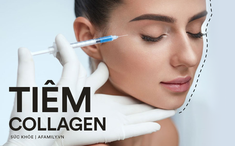 Tiêm collagen làm đẹp da, làn da người phụ nữ nổi sần khắp mặt phải cầu cứu bác sĩ