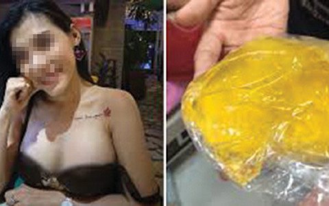 Những chuyện bi hài mang tên túi ngực silicon