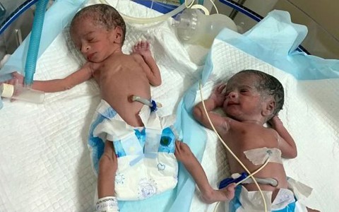 Ca sinh nở hy hữu: Sản phụ già nhất thế giới chào đón cặp sinh đôi ở tuổi 74