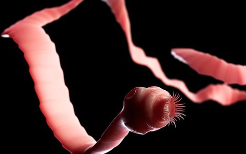Sán xơ mít sống trong bụng bệnh nhân nhiều năm do thói quen ăn uống mà hầu như người Việt nào cũng mắc