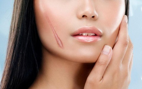 Chuyên gia chỉ ra cách phân biệt sẹo lồi và sẹo phì đại chuẩn xác để tìm ra hướng điều trị đúng