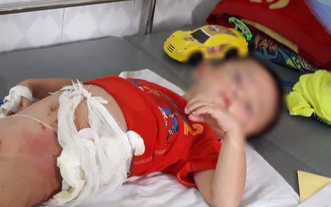 Thông tin sốc về người bác ruột ném cháu vào đống lửa vì tranh ăn dưa