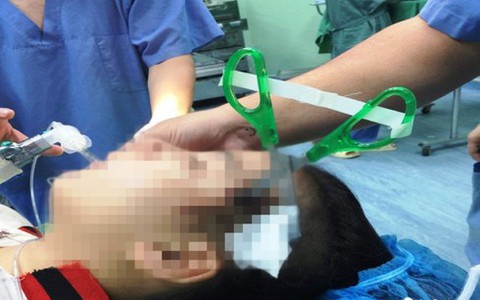 Nghệ An: Bị kéo nhọn găm vào đầu 3cm, bé gái 10 tuổi nhập viện nguy kịch
