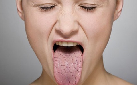 Gặp vấn đề về vị giác có thể là tín hiệu cảnh báo bạn đang gặp những tình trạng sức khỏe nghiêm trọng như thế này
