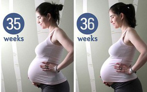 Các mẹ bầu nên nhanh chóng chuẩn bị tinh thần "xách làn" đi đẻ khi thấy 9 dấu hiệu chuyển dạ dưới đây