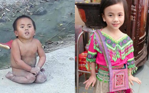Hình ảnh mới nhất của Pàng - Em bé Mường Lát không có quần áo ngồi bệt giữa trời giá rét trong ngày đầu năm Canh Tý