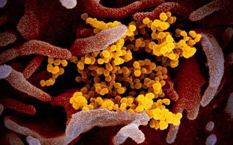 Hình ảnh chân thực nhất của virus corona Covid-19 mới được các nhà khoa học công bố
