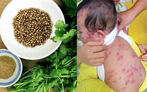 BS Minh Tân: Đúng và sai khi dùng hạt/ lá mùi phòng tránh bệnh sởi