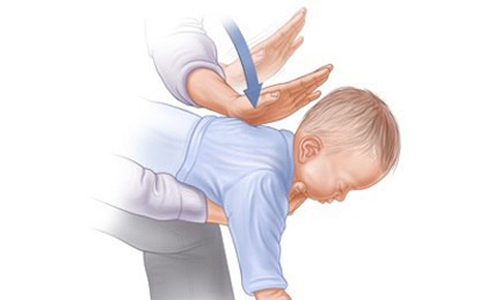 Hai cách sơ cứu nhanh khi trẻ bị hóc dị vật cha mẹ cần biết