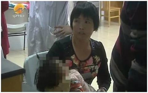 Bà ngoại bất cẩn, bé 1 tuổi nguy kịch vì bị đũa đâm xuyên miệng