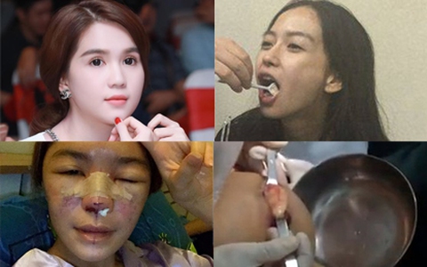 Những "lùm xùm" phẫu thuật thẩm mỹ được chú ý nhiều nhất năm 2015  