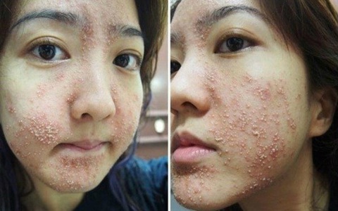 Son handmade, kem trộn và những hiểm họa khôn lường khi sử dụng 