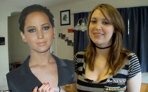Bà mẹ phẫu thuật 6 lần để xinh đẹp như Jennifer Lawrence