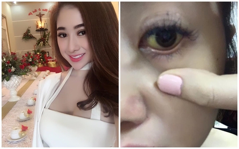 Thực hư vụ cô gái xinh đẹp thon thả nhưng vẫn "cuồng" thuốc giảm cân đến suýt chết
