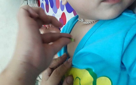 Thực hư phương pháp chữa ho “bách phát bách trúng” không cần kháng sinh đang lan truyền ầm ĩ trên mạng