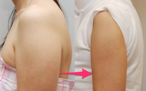 Tuyệt chiêu thu gọn bắp tay cực kì hiệu quả chỉ trong 7 ngày