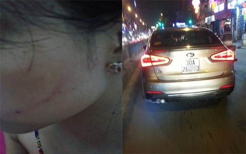Hà Nội: Cô gái trẻ bị tài xế dừng xe ô tô tát “đỏ má” vì không cho vượt?