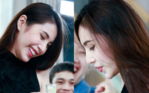Thủy Tiên vô tình để lộ cằm gập ghềnh - Bằng chứng của "dao kéo"?