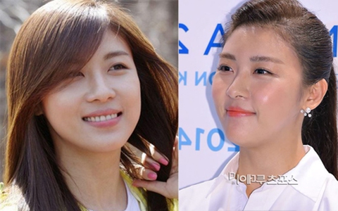 Ha Ji Won trẻ nhưng mặt ngày càng thiếu tự nhiên ở tuổi 36 