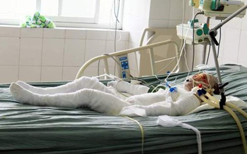 Cháu bé thứ 2 vụ cả nhà bị tưới xăng thiêu sống đã chết