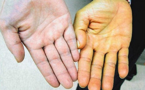 Ung thư giai đoạn cuối, cơ hội sống chỉ còn 5%, vị giáo sư vẫn khỏe mạnh 16 năm chỉ nhờ bí quyết 3 chữ đơn giản