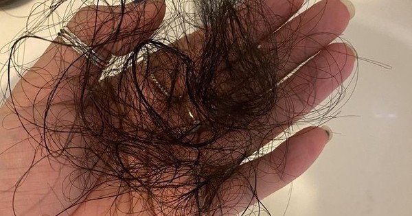 Bạn đang tự đẩy mình vào “thảm cảnh” tóc rụng cả nắm vì gội đầu sai giờ