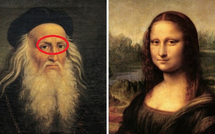 Lý giải y học về nụ cười bí ẩn của nàng Mona Lisa