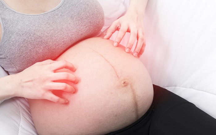Ngứa khi mang thai, dấu hiệu nguy hiểm tới thai nhi