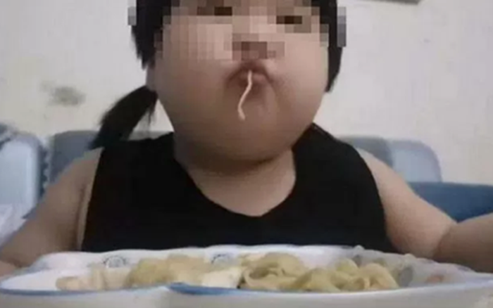 Bé gái 8 tuổi nặng 45kg và gan nhiễm mỡ: Nguyên nhân và giải pháp sức khỏe