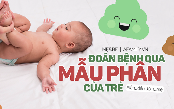 Gợi Ý Bố Mẹ Cách Đoán Bệnh Qua Từng Mẫu Phân Của Trẻ Nhỏ