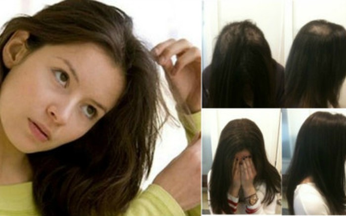 Netizen vò đầu bứt tóc tính thời gian Vy Oanh sinh con: Tháng 3 khoe bụng
